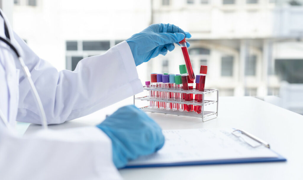 Exames de sangue Exames de sangue